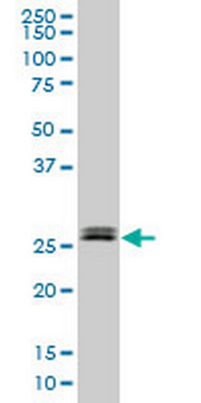 TGIF2 Antibody in Western Blot (WB)