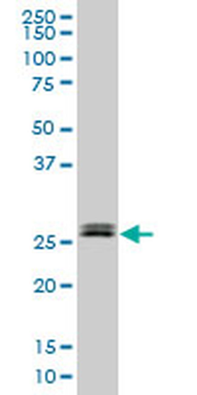 TGIF2 Antibody in Western Blot (WB)