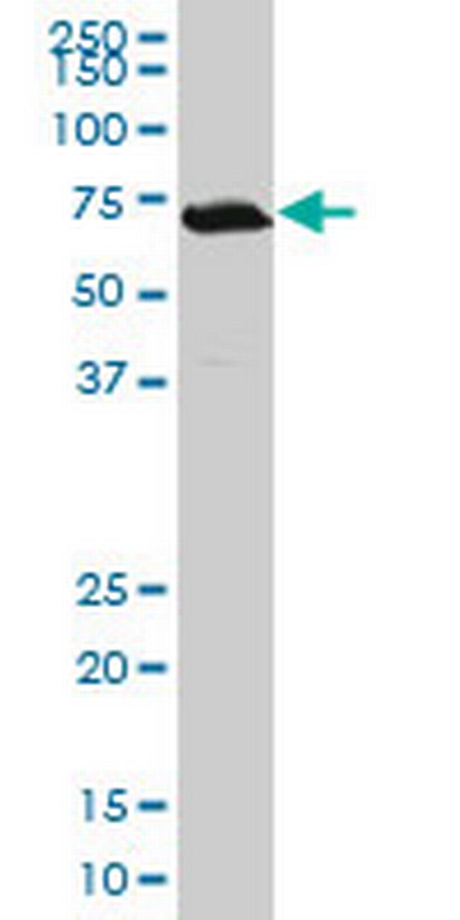 TGIF2 Antibody in Western Blot (WB)