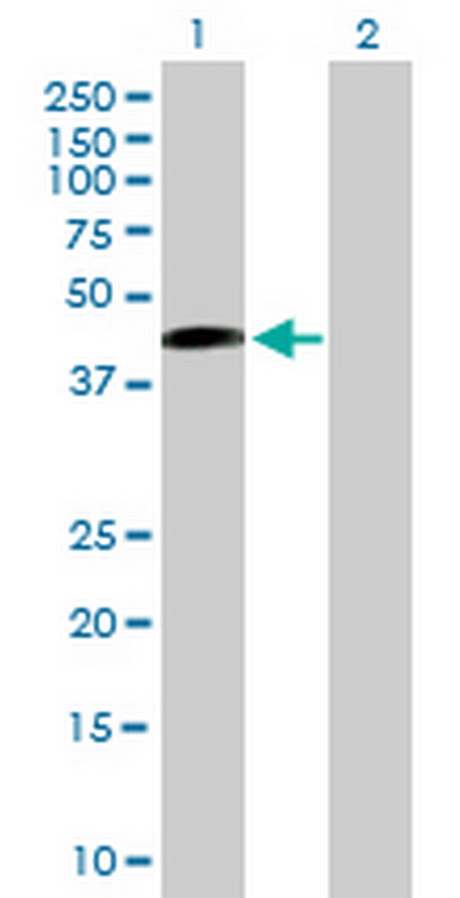 SAV1 Antibody in Western Blot (WB)