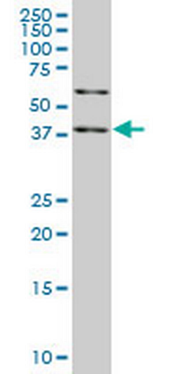 SAV1 Antibody in Western Blot (WB)