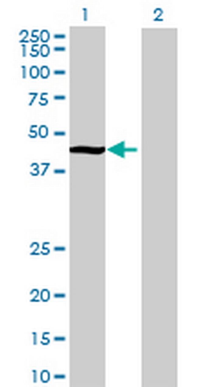 C6orf75 Antibody in Western Blot (WB)