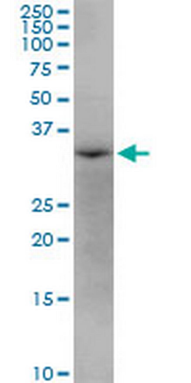 AASDHPPT Antibody in Western Blot (WB)