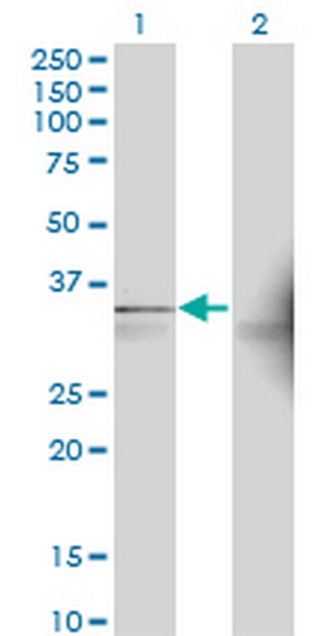 AASDHPPT Antibody in Western Blot (WB)