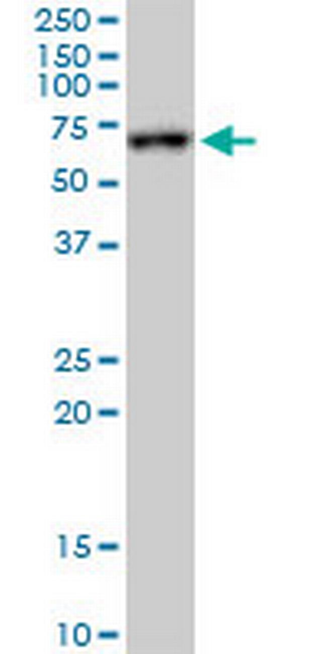 FKBP10 Antibody in Western Blot (WB)