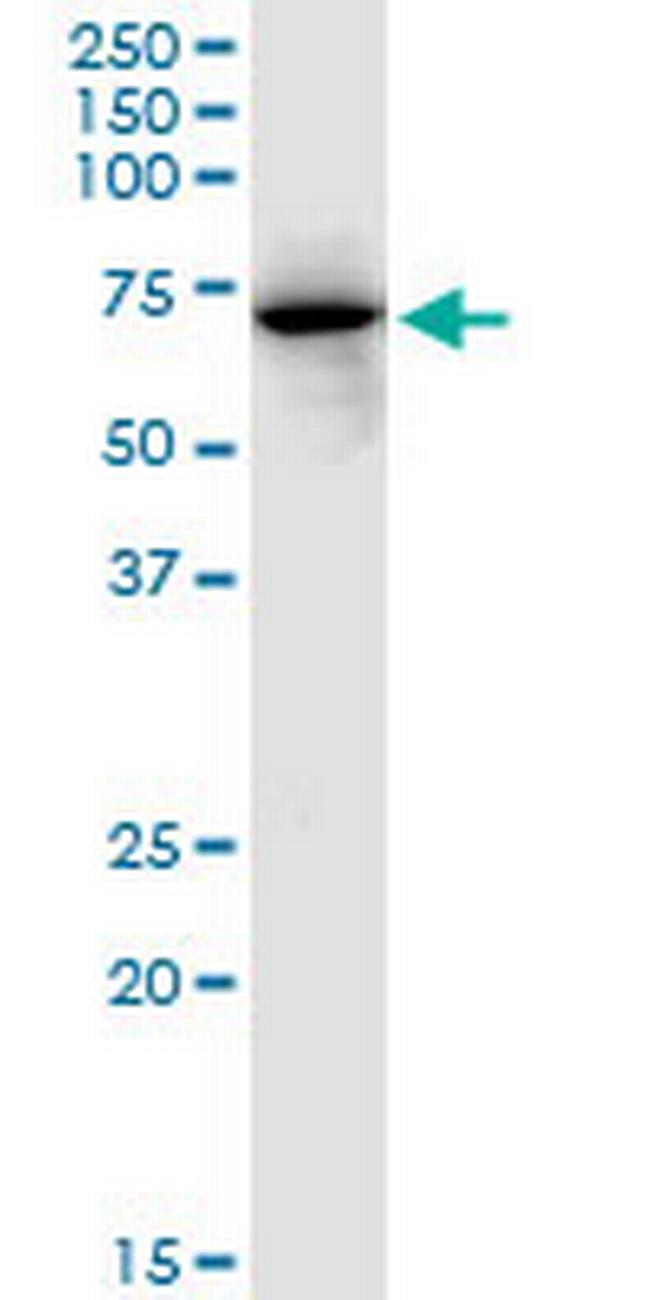 FKBP10 Antibody in Western Blot (WB)