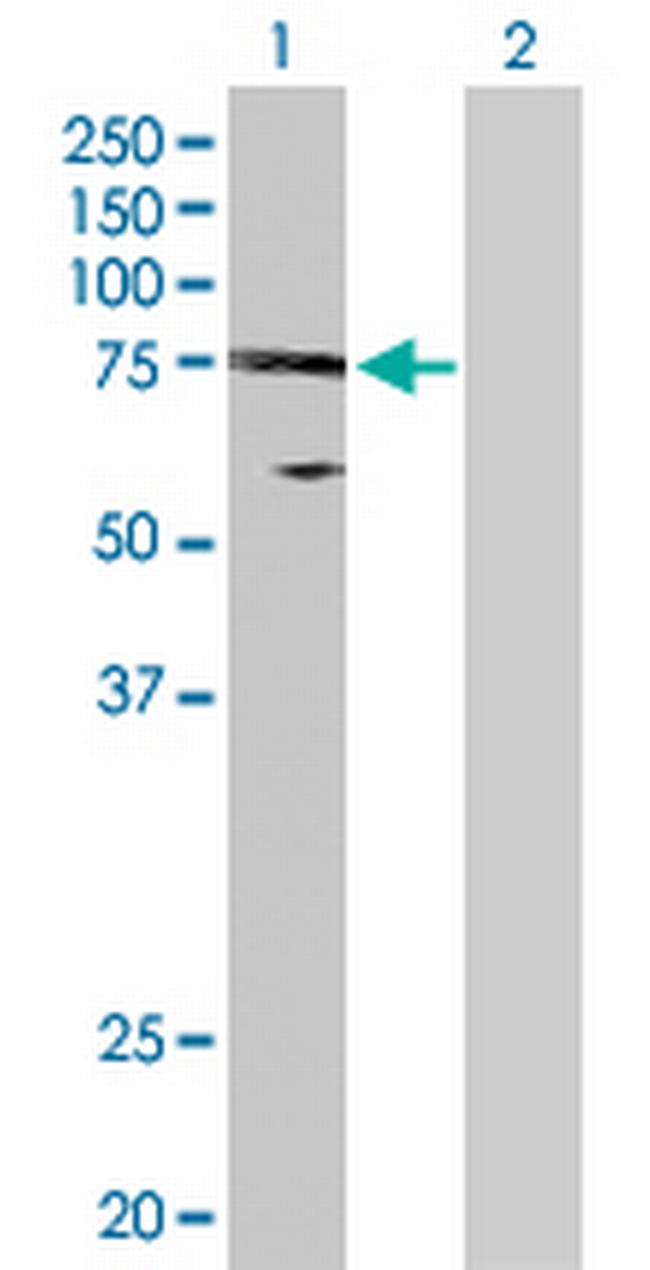 UBE2O Antibody in Western Blot (WB)