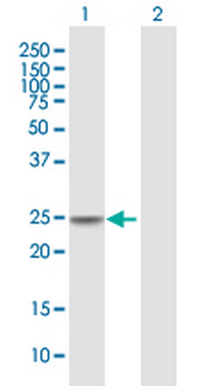 CIDEC Antibody in Western Blot (WB)