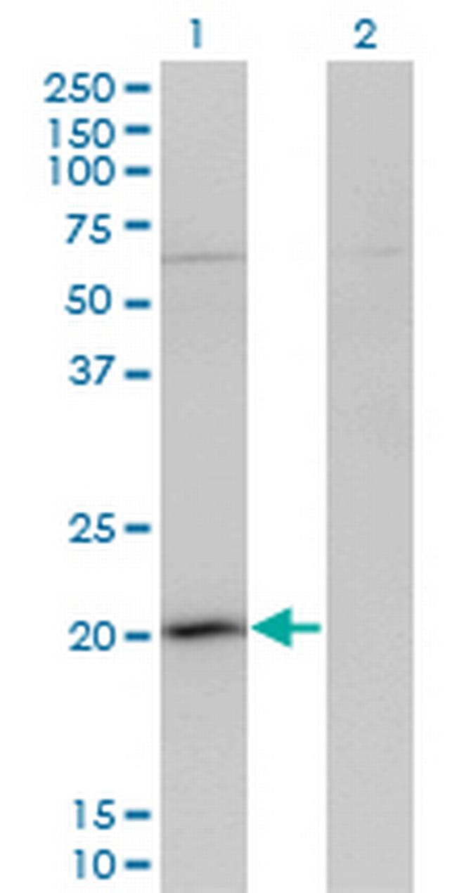 GPSM3 Antibody in Western Blot (WB)