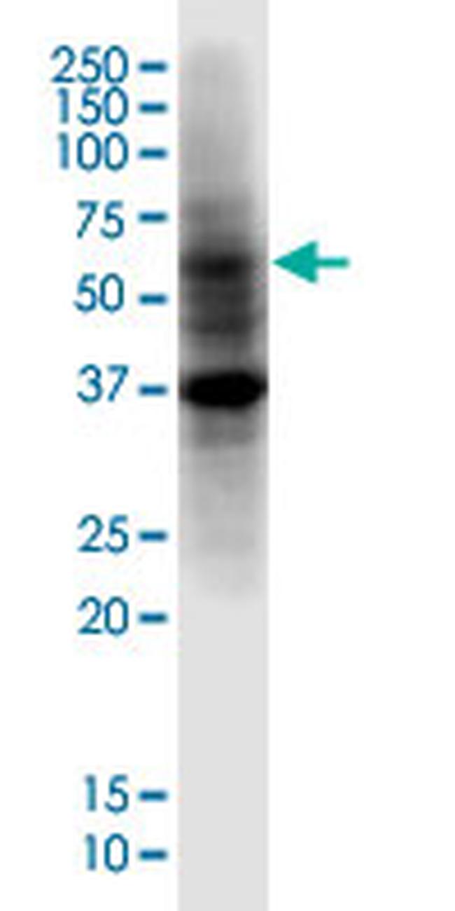 PRDM14 Antibody in Western Blot (WB)