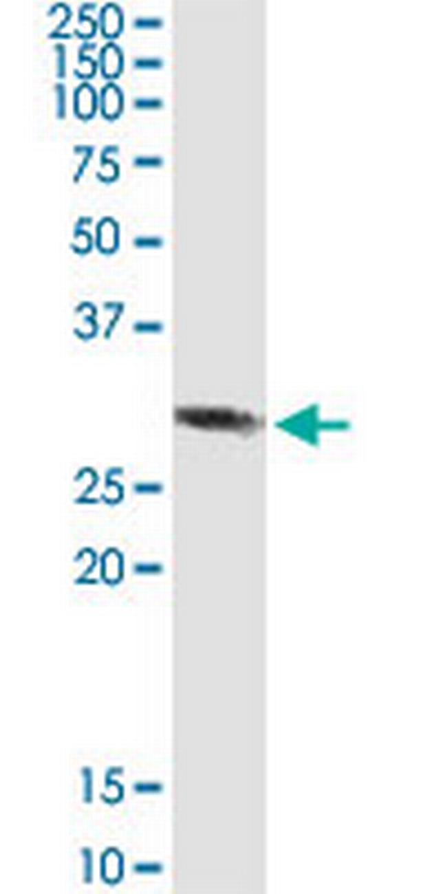 RBKS Antibody in Western Blot (WB)