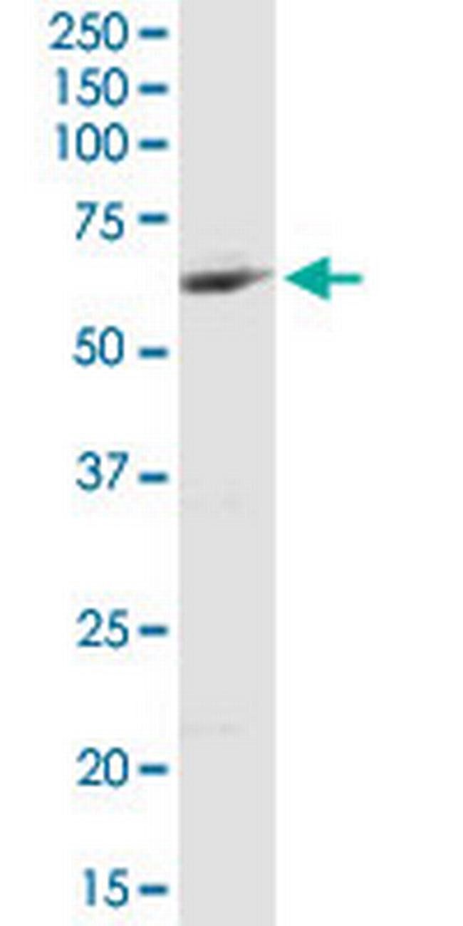 MCCC2 Antibody in Western Blot (WB)