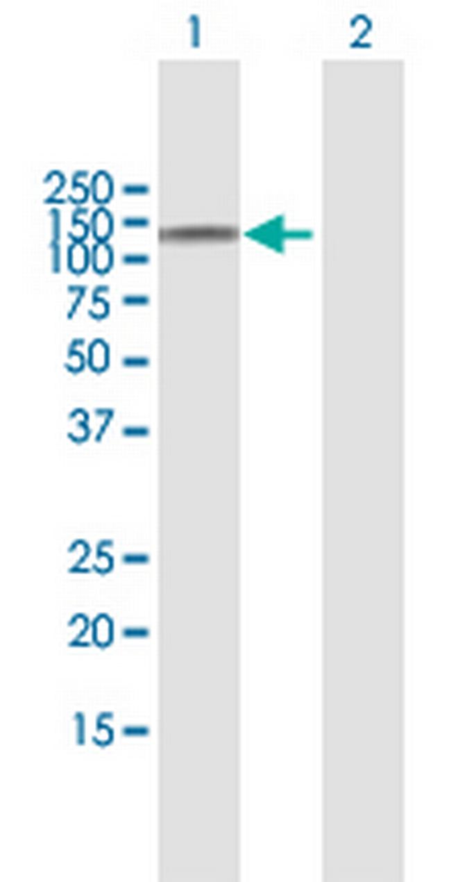 NOD2 Antibody in Western Blot (WB)