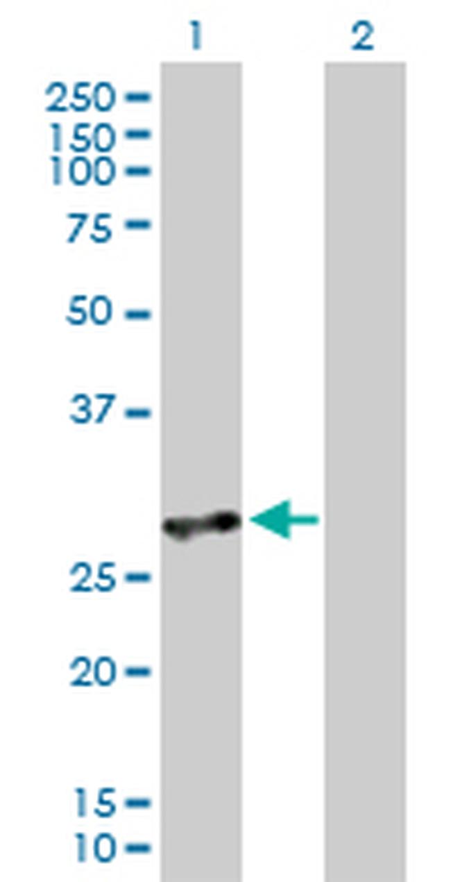 IFIH1 Antibody in Western Blot (WB)