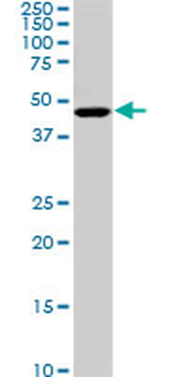 C17ORF75 Antibody in Western Blot (WB)