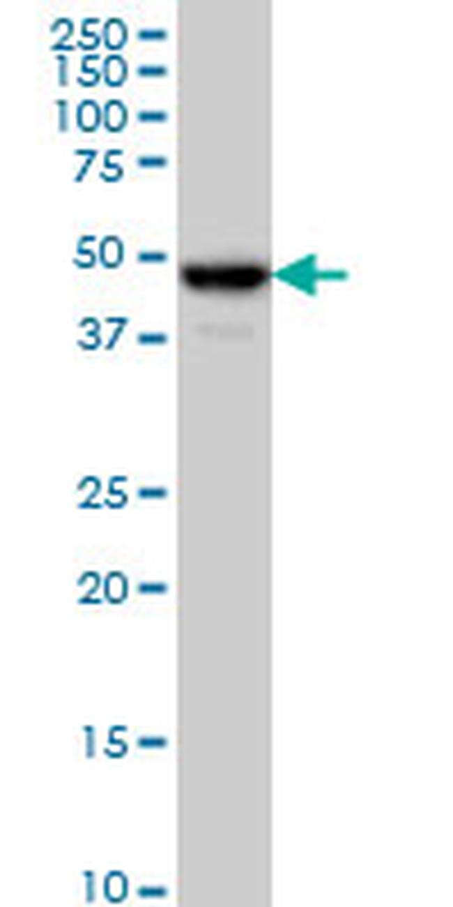 C17ORF75 Antibody in Western Blot (WB)