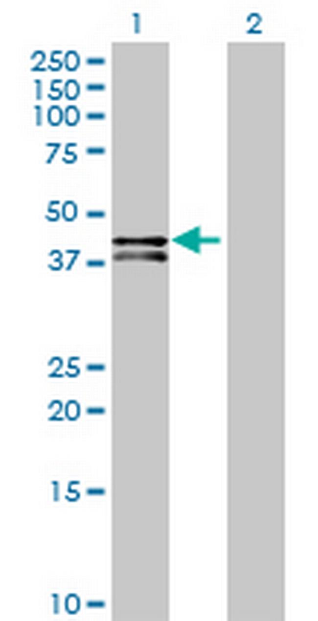 OSGEPL1 Antibody in Western Blot (WB)