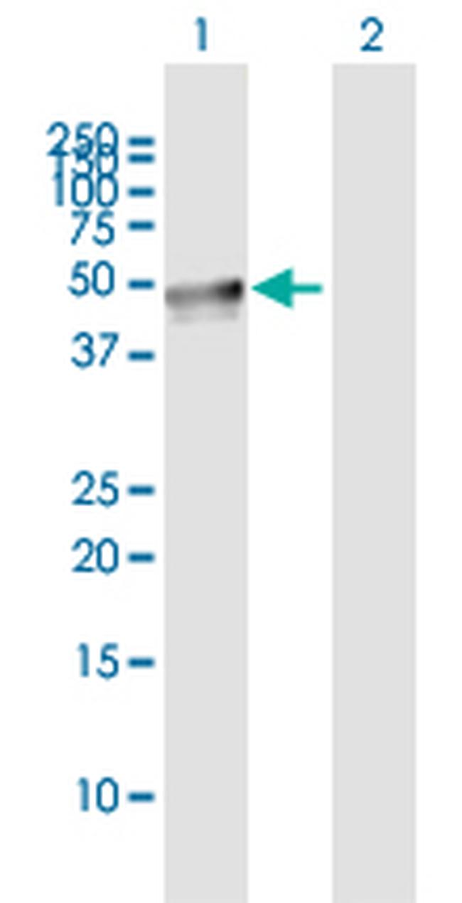 LEPRE1 Antibody in Western Blot (WB)