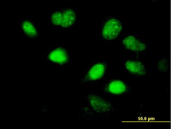 LHX5 Antibody in Immunocytochemistry (ICC/IF)