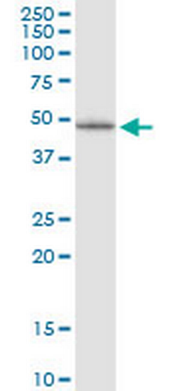 LHX5 Antibody in Western Blot (WB)