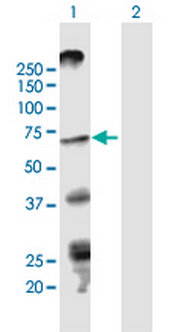 STRA6 Antibody in Western Blot (WB)