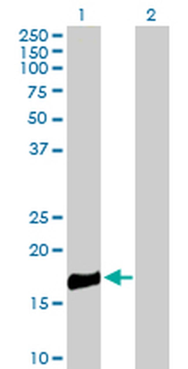 ROBO3 Antibody in Western Blot (WB)