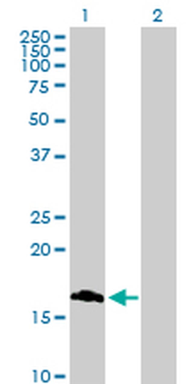 ROBO3 Antibody in Western Blot (WB)