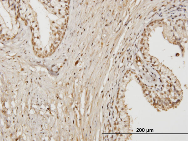 RAB17 Antibody in Immunohistochemistry (Paraffin) (IHC (P))