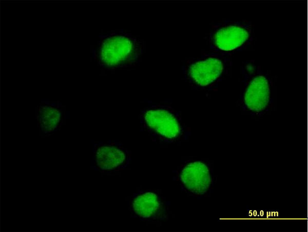 IKZF4 Antibody in Immunocytochemistry (ICC/IF)