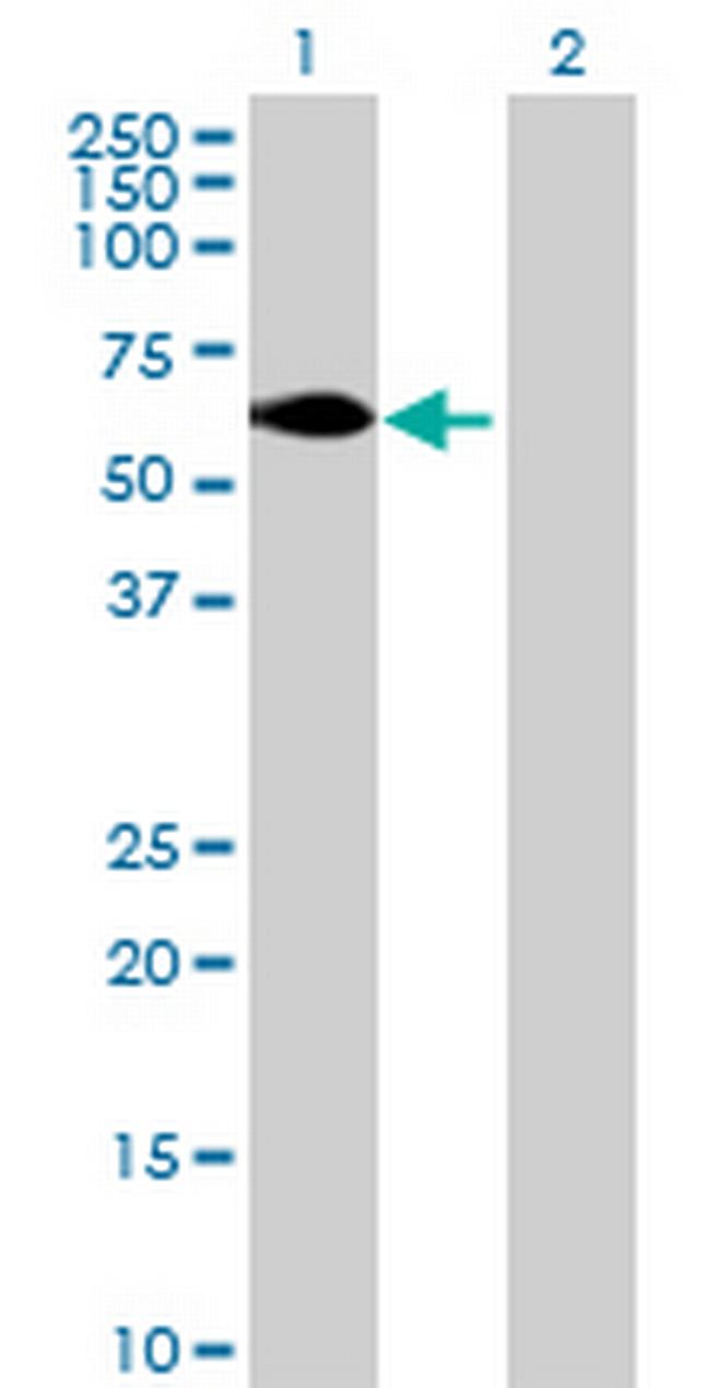 ZNFN1A5 Antibody in Western Blot (WB)