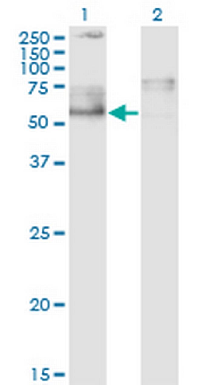 ZNFN1A5 Antibody in Western Blot (WB)