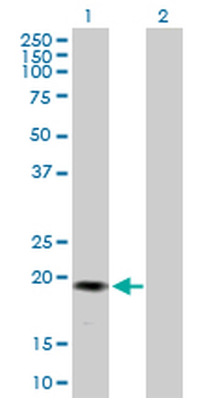 GREM2 Antibody in Western Blot (WB)