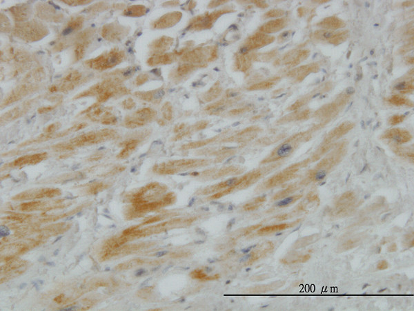 HHIP Antibody in Immunohistochemistry (Paraffin) (IHC (P))