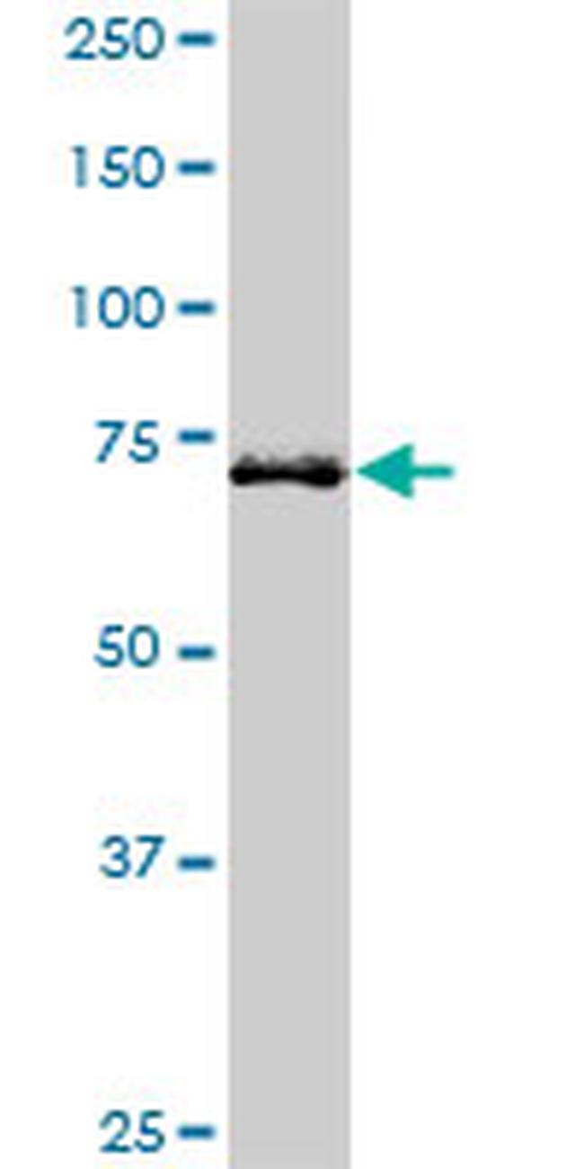 HHIP Antibody in Western Blot (WB)