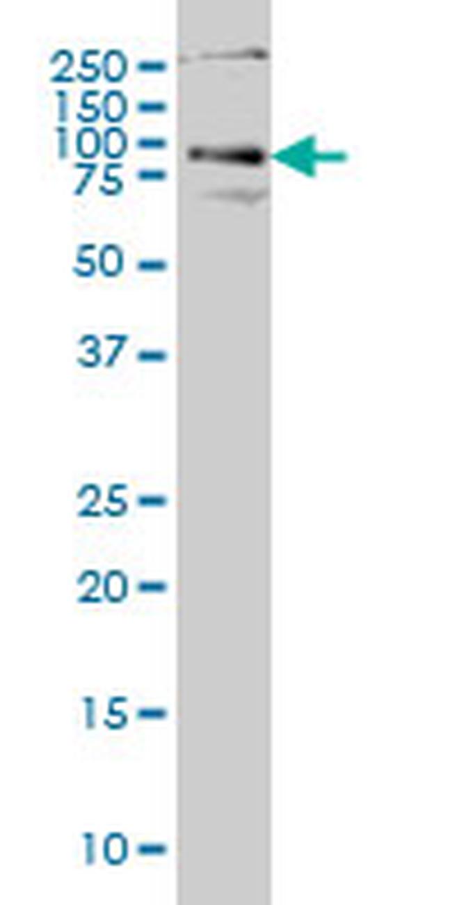 HHIP Antibody in Western Blot (WB)