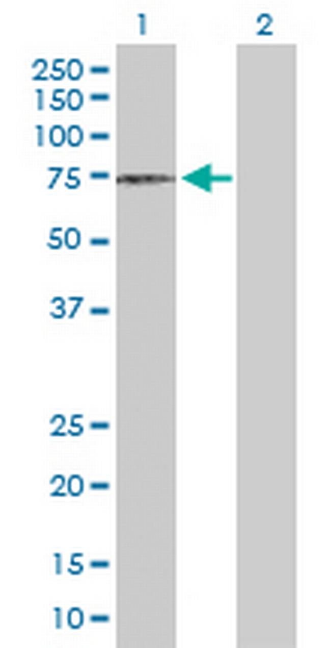 DCLRE1C Antibody in Western Blot (WB)