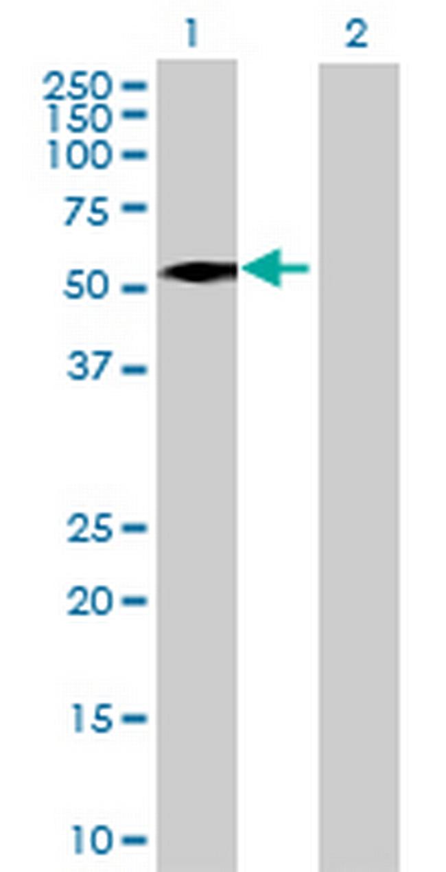 ALDH8A1 Antibody in Western Blot (WB)