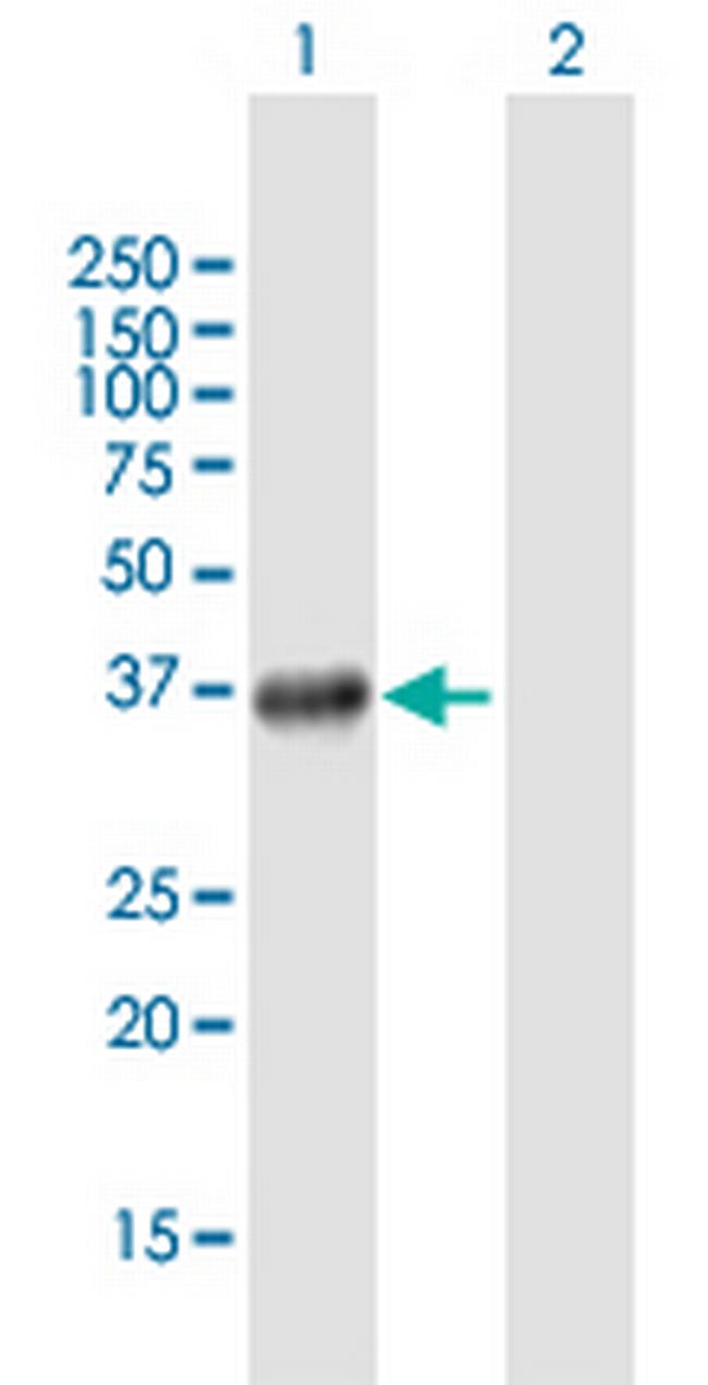 SMYD3 Antibody in Western Blot (WB)