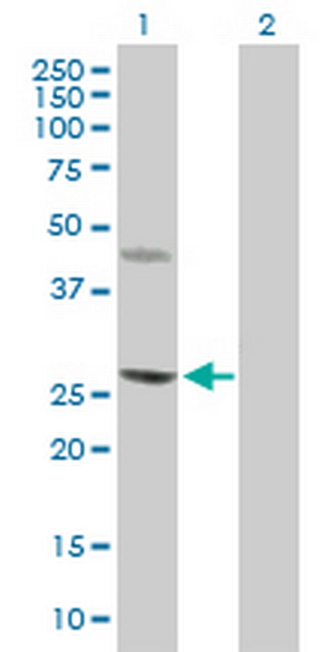 CERK Antibody in Western Blot (WB)