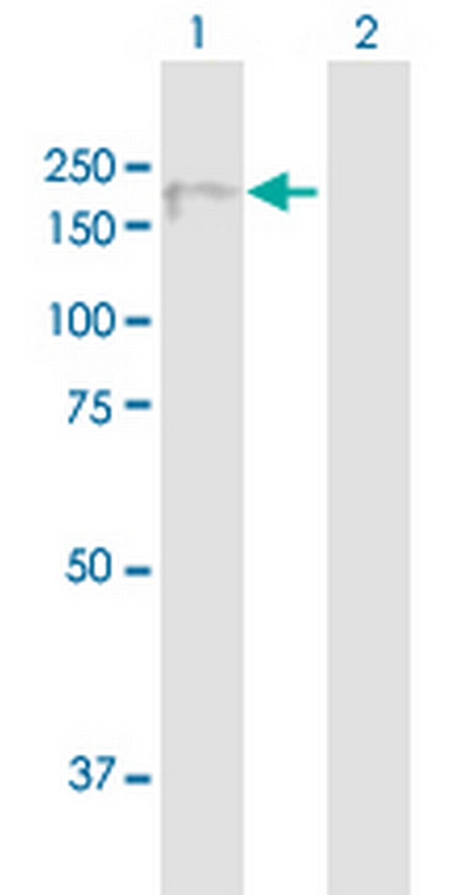 FLJ23588 Antibody in Western Blot (WB)