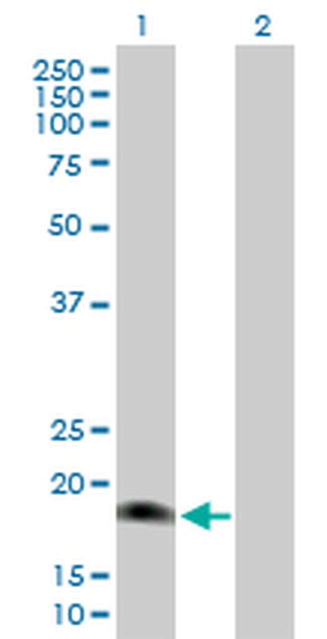 IL17E Antibody in Western Blot (WB)