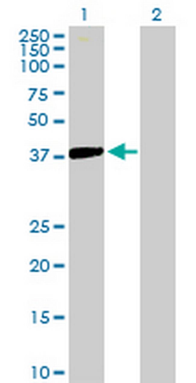 ISL2 Antibody in Western Blot (WB)