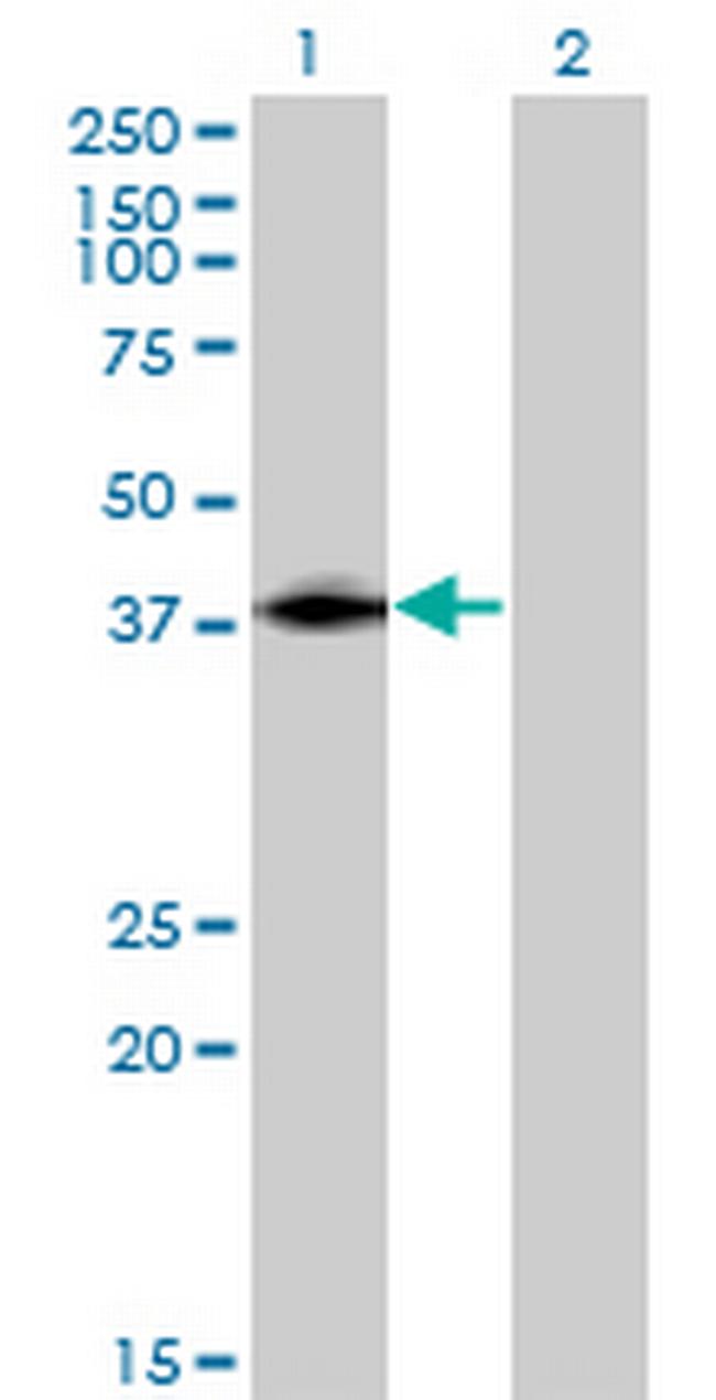 ISL2 Antibody in Western Blot (WB)