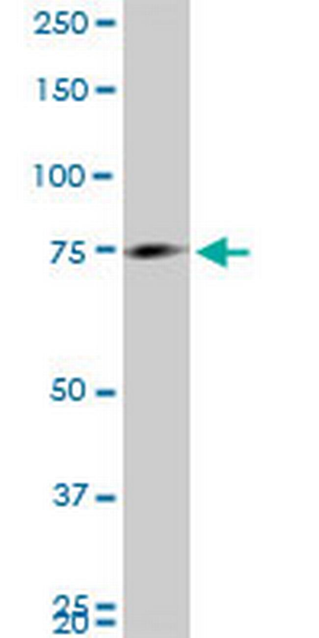 MARCH7 Antibody in Western Blot (WB)