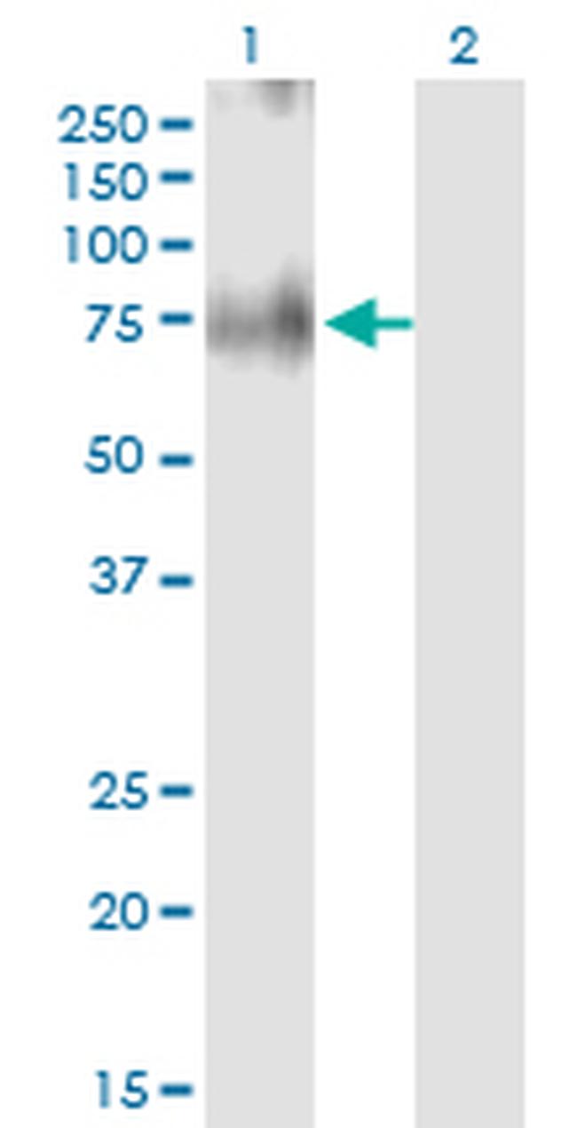 SLC30A5 Antibody in Western Blot (WB)