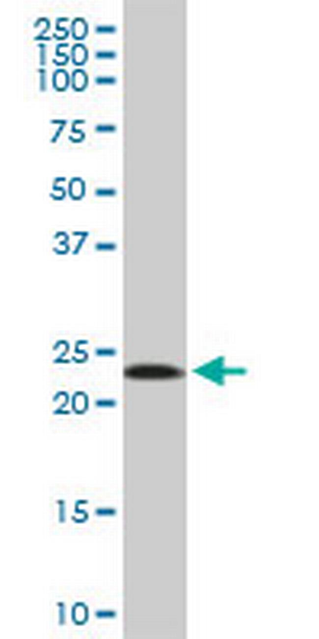 MRPL11 Antibody in Western Blot (WB)