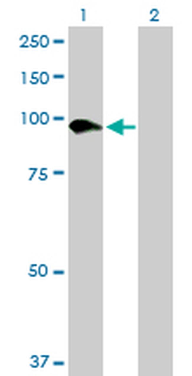 SLC26A6 Antibody in Western Blot (WB)