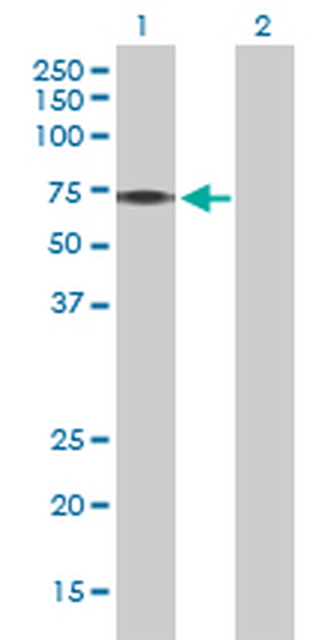 PINK1 Antibody in Western Blot (WB)