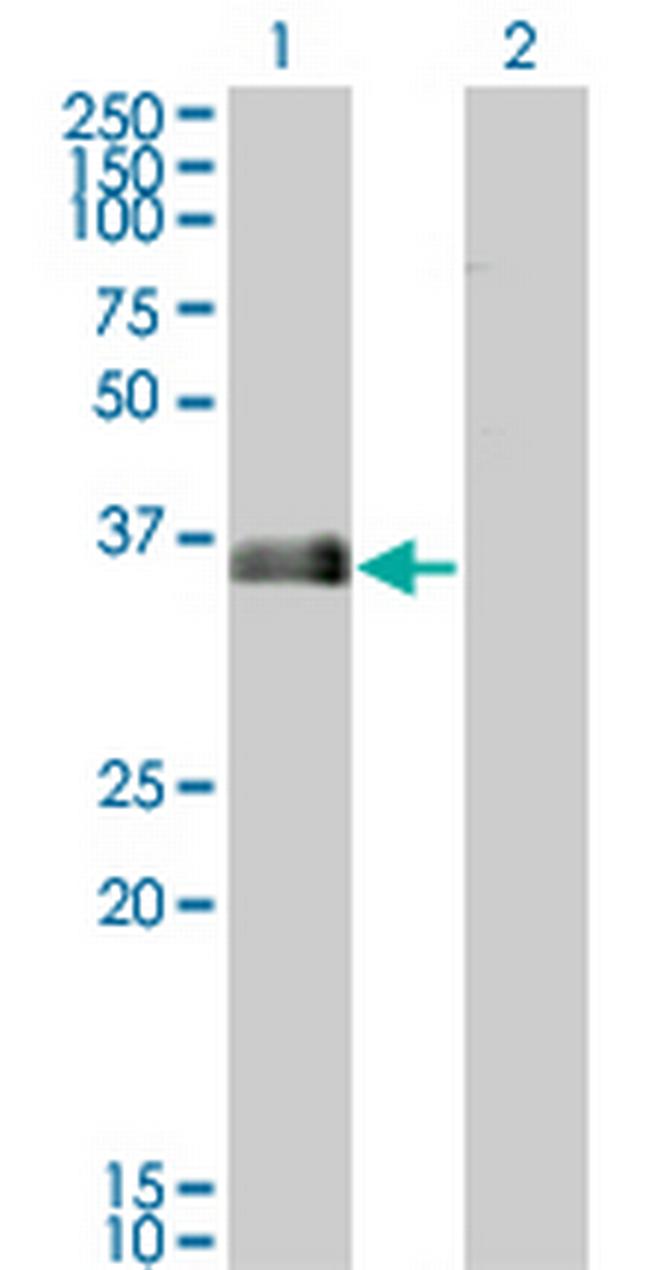 MARCKSL1 Antibody in Western Blot (WB)