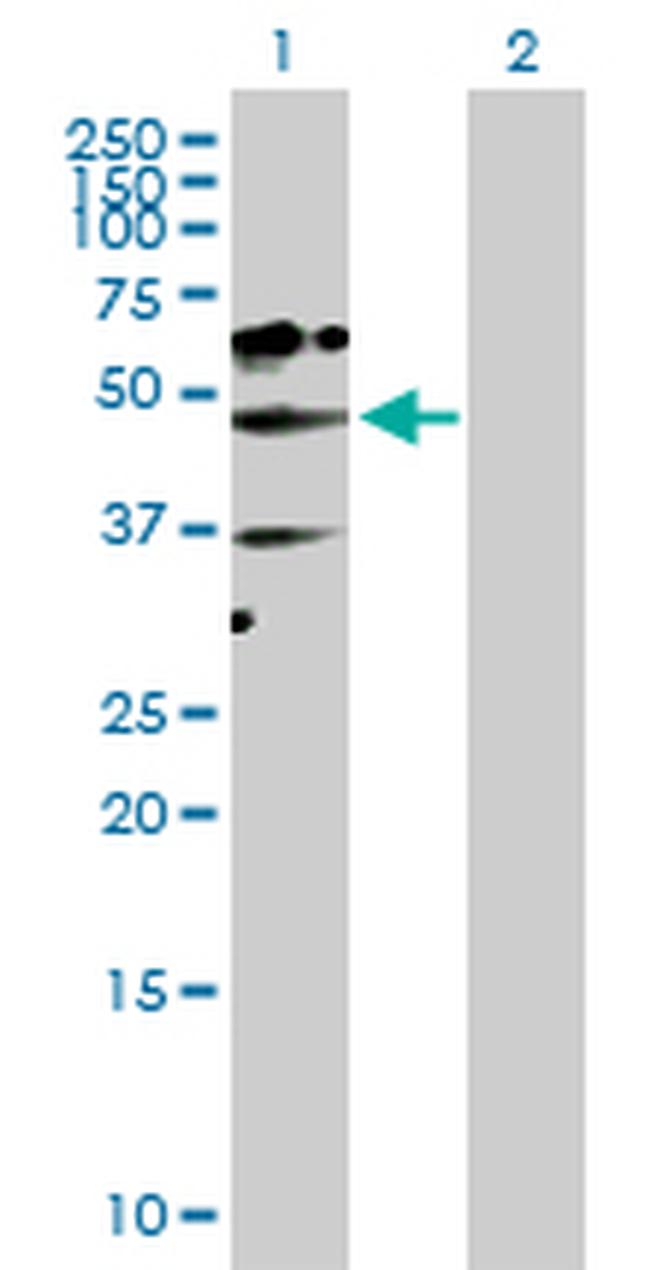 NADK Antibody in Western Blot (WB)